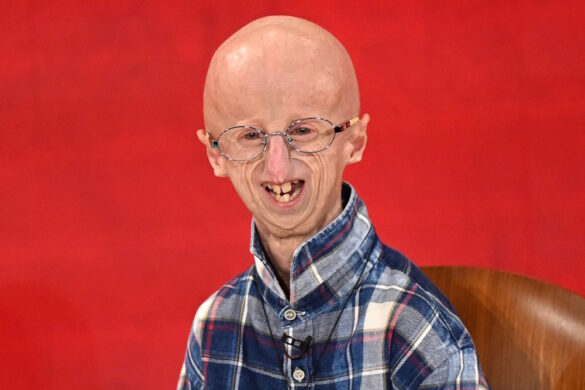 Sammy Basso Archives